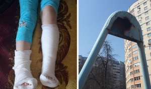 В Минске школьница с загипсованной ногой села на качели, а те рухнули: сломана вторая нога. Фото предоставлено Надеждой Матяс