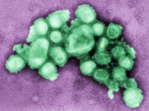 В Грузии жертвами свиного гриппа стали уже восемь человек