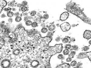 В Египте выявлен первый случай заражения новым коронавирусом