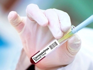 Более 20 тысяч волонтеров согласились заразиться схожими с COVID-19 вирусами за 4,4 тысячи долларов