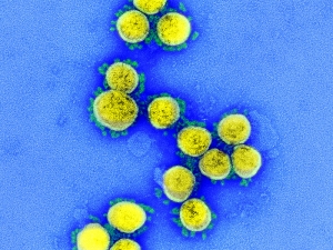 Ученые выяснили температуры наибольшей и наименьшей живучести коронавируса
